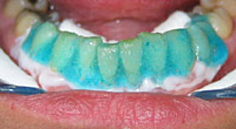Implantologisch ttige Zahnarztpraxis