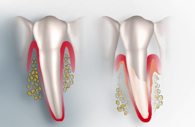 Implantologisch t�tige Zahnarztpraxis